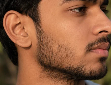 Patchy beard image showing new facial hair growth, sparse cheek beard, light jawline beard, uneven beard density, fuller-looking beard progress, and minoxidil beard growth results.
