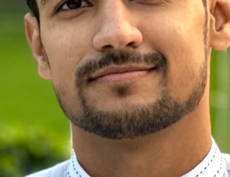 Patchy beard improvement image showing light facial hair, thin cheek beard, shaped jawline beard, fuller-looking beard growth, and minoxidil beard journey.