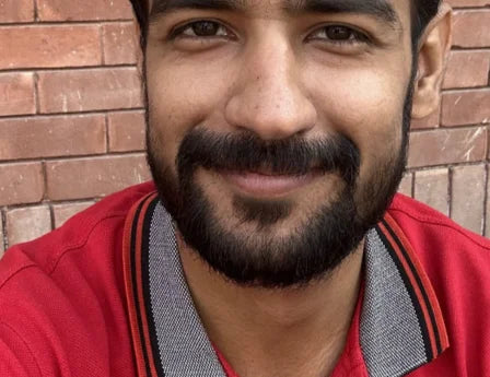 Fuller beard image showing improved facial hair density, thicker jawline beard, fuller-looking beard, beard growth results, and minoxidil beard growth progress.