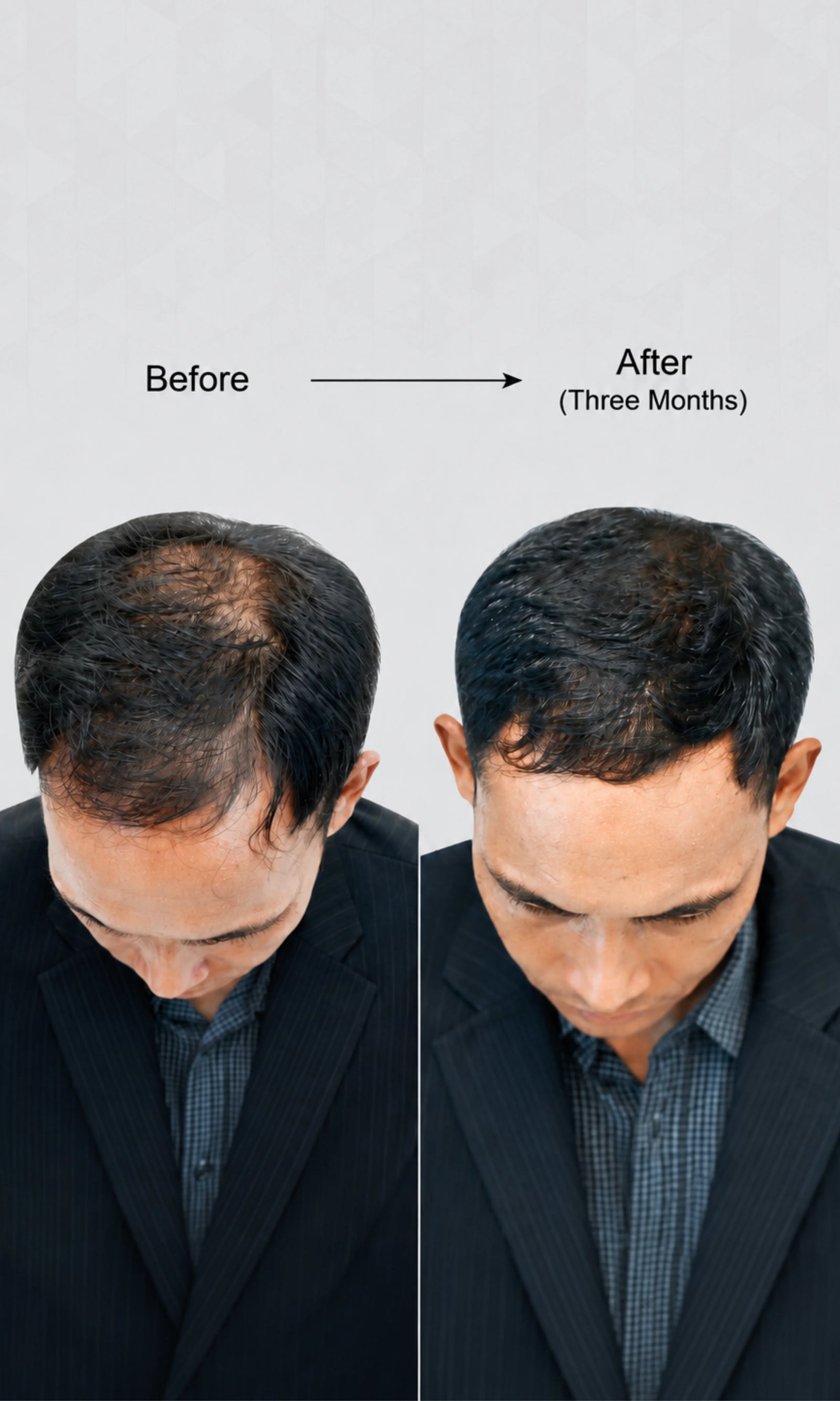 Hair oil before and after results for thinning hair, hair fall control, scalp care, fuller-looking hair, stronger hair, and healthy hair growth.